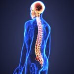Yuk Kenali Apa itu Spinal Cord Injury, Gejala, dan Penyebabnya