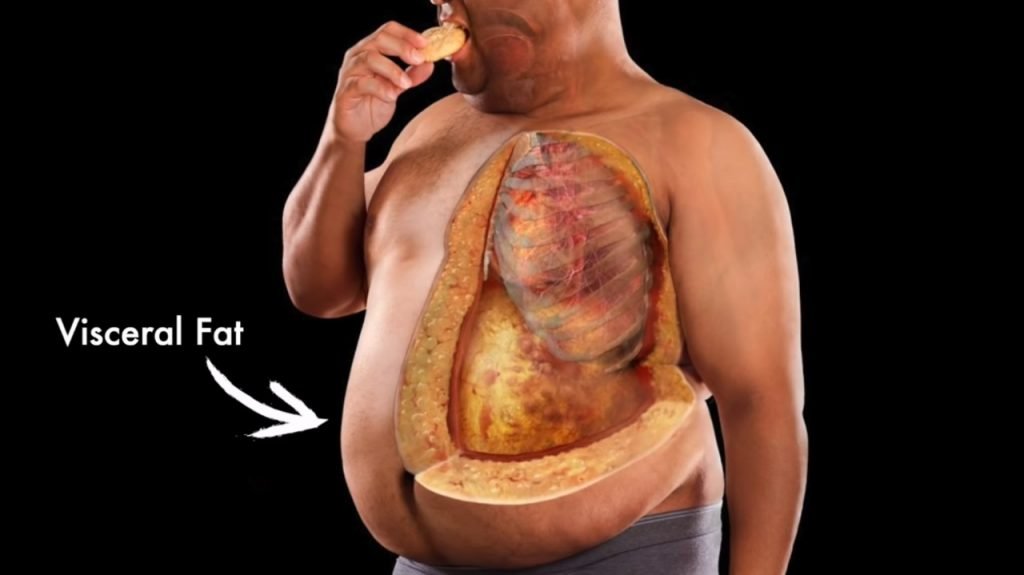 Hubungan Kejadian Obesitas Abdominal dengan Diabetes Mellitus Tipe 2